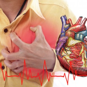 Life Insurance After Heart Attack – How Much Does It Cost?